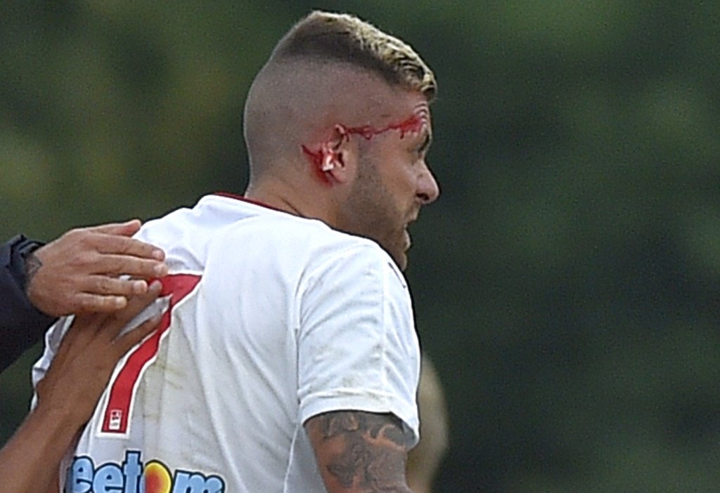 Bordeaux : Oreille coupée pour Jérémy Ménez !